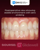 Advanced Periodontology: Surgical Protocols