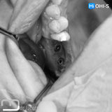 Predictable Sinus Lift