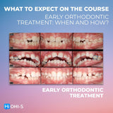Early Orthodontic Treatment: When and How?