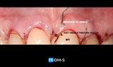 Advanced Periodontology: Surgical Protocols