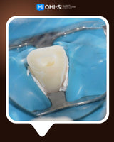 Dental Trauma Without Drama