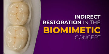 Indirect Restoration in the Biomimetic Concept