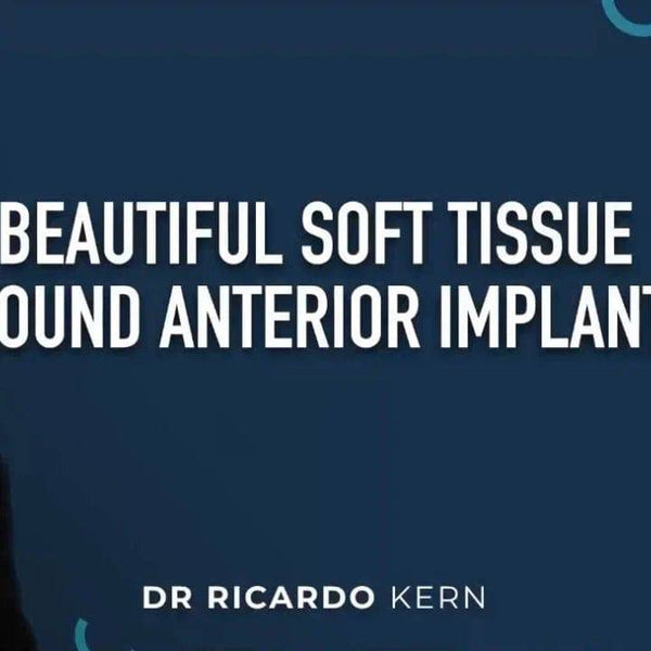 Beautiful Soft Tissue Around Anterior Implants