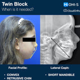 Orthodontics for Children and Teenagers