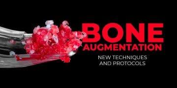 Bone augmentation 2.0. New techniques and protocols
