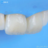 The Biomimetic Concept: Composite Restoration Protocols