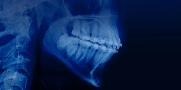 Orthodontic Treatment in Patients with Periodontal and Alveolar Bone Pathology