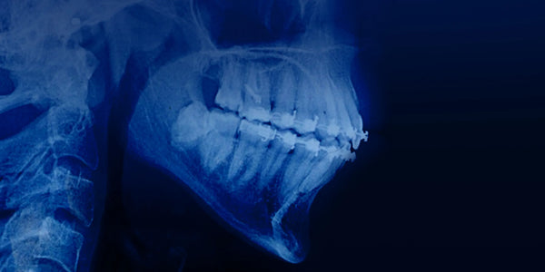 Orthodontic Treatment in Patients with Periodontal and Alveolar Bone Pathology