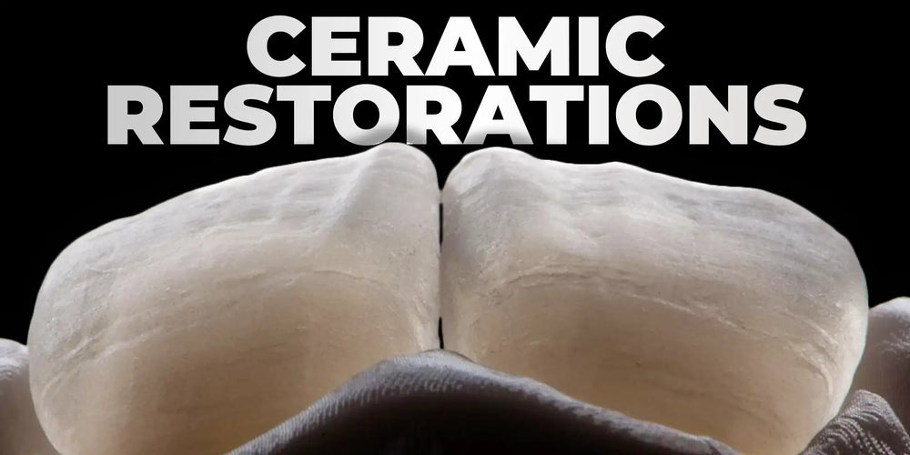 Ceramic restorations of frontal teeth