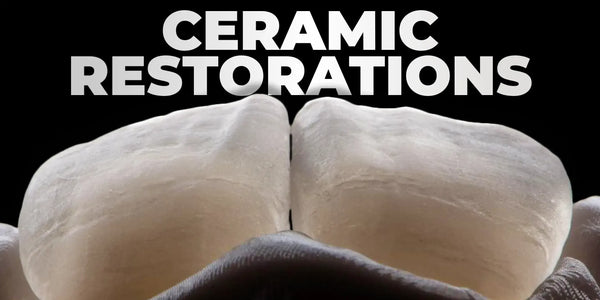 Ceramic restorations of frontal teeth