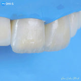 The Biomimetic Concept: Composite Restoration Protocols