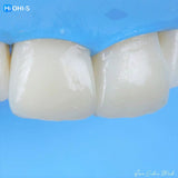 The Biomimetic Concept: Composite Restoration Protocols