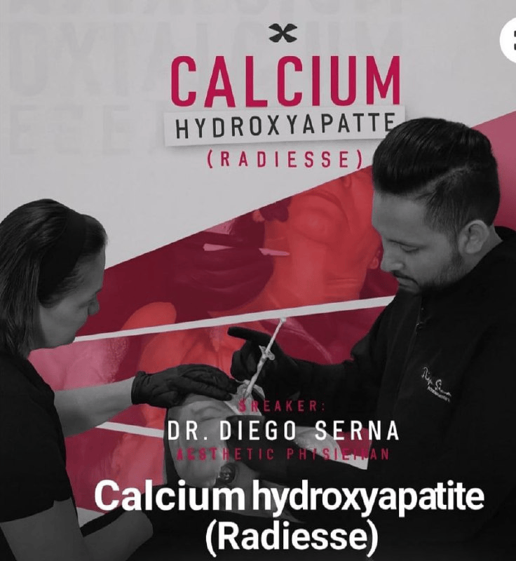 Calcium Hydroxyapatite (Radiesse) Dr. Diego Serna