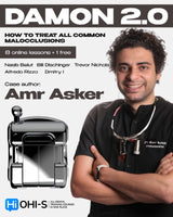Damon 2.0. How to treat all common malocclusions