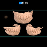 Removable dentures for dentists and technicians