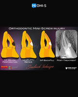 Saving Hopeless Teeth: Surgical and Conservative Protocols