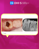 Pediatric Dentistry School