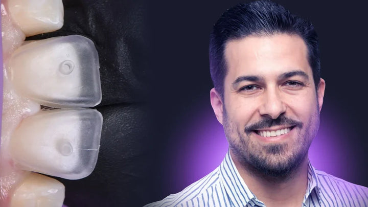 البروتوكول الحديث للحشوات بمادة الفلوبل  كومبوزت