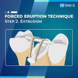 Saving Hopeless Teeth: Surgical and Conservative Protocols