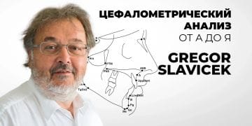 Cephalometric Analysis from A to Z: Everything a Dentist Needs to Know