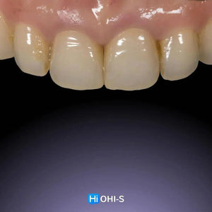 Ceramic Layering: Protocols of the World’s Leading Schools