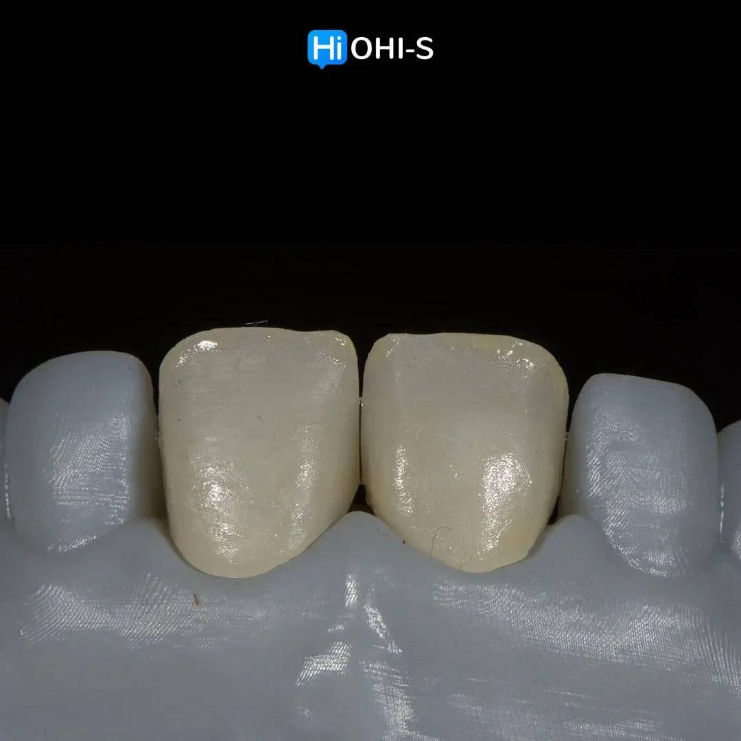 Ceramic Layering: Protocols of the World’s Leading Schools