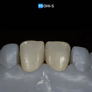 Ceramic Layering: Protocols of the World’s Leading Schools