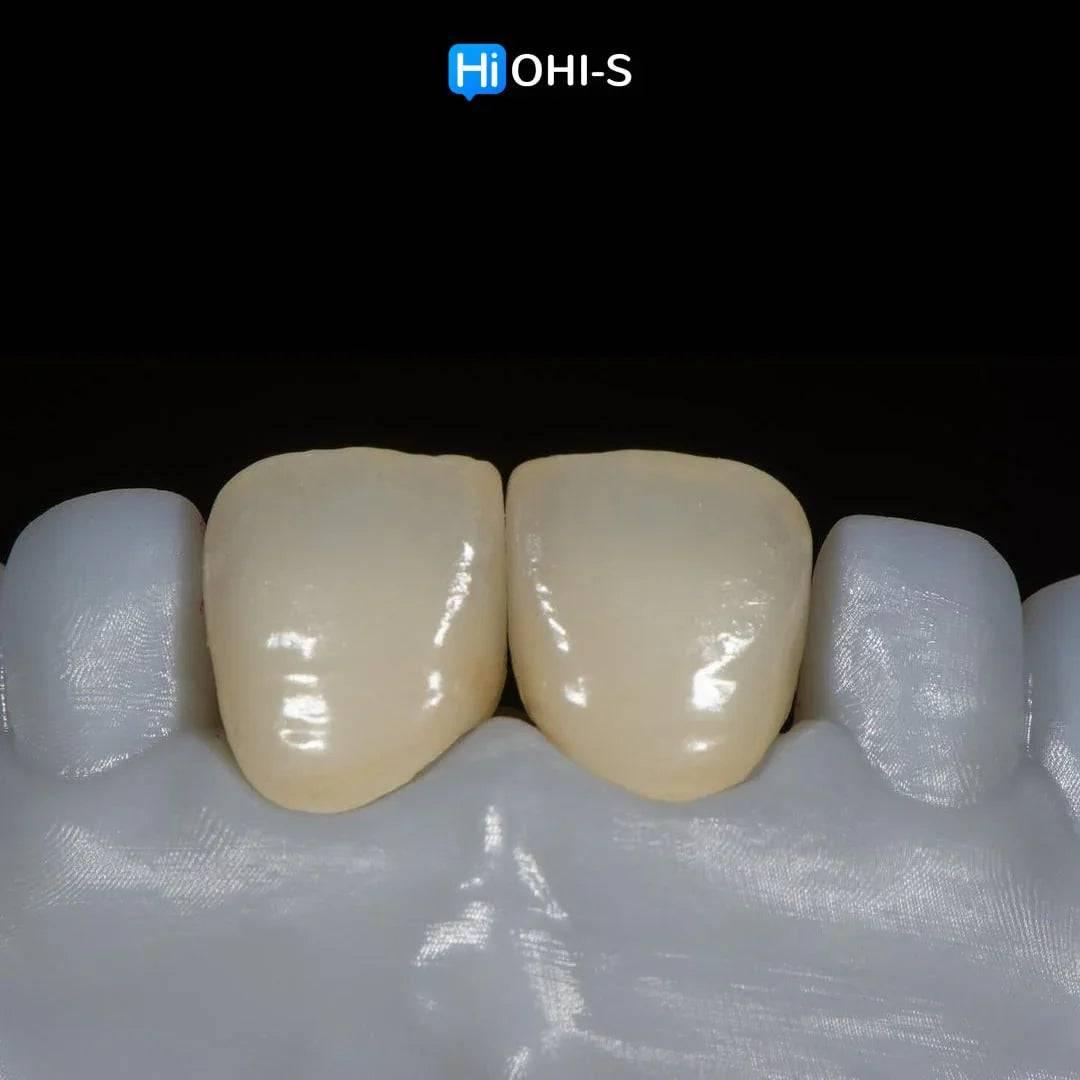 Ceramic Layering: Protocols of the World’s Leading Schools