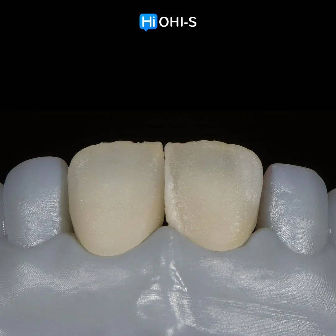 Ceramic Layering: Protocols of the World’s Leading Schools