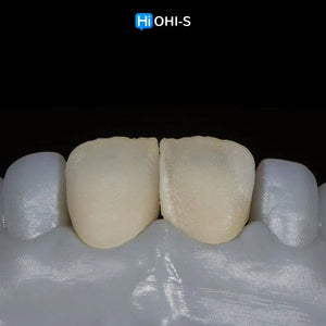 Ceramic Layering: Protocols of the World’s Leading Schools