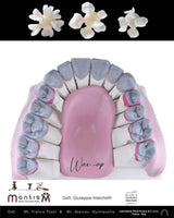 Ceramic Restorations:  Veneers, Inlays, Crowns