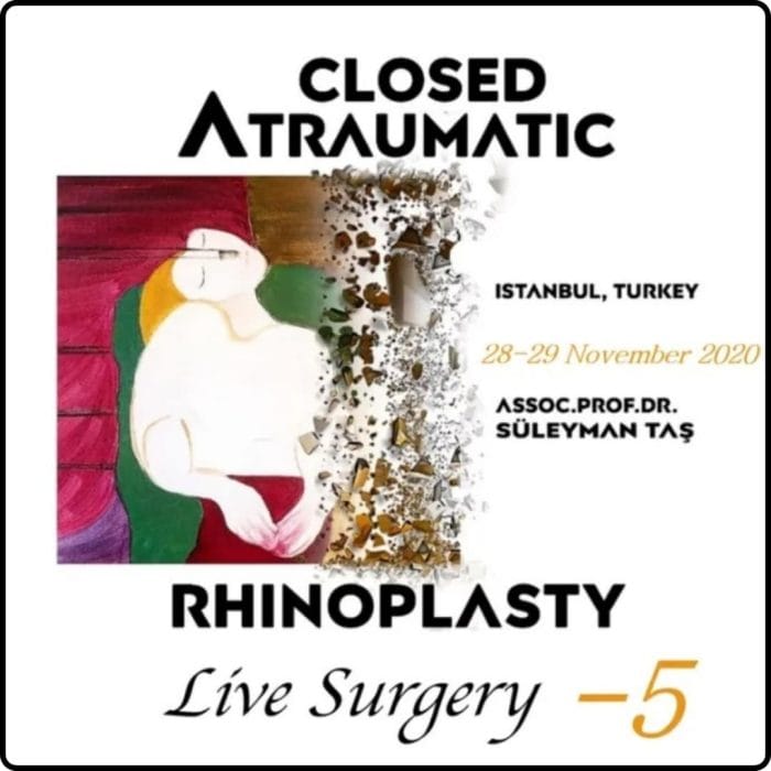 Closed Atraumatic Rhinoplasty Live Surgery