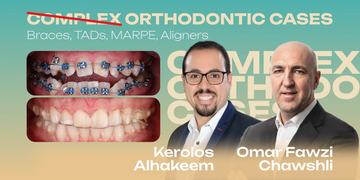 Complex Orthodontic Cases: Brackets, TADs, MARPE and Aligners