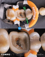 The Biomimetic Concept: Composite Restoration Protocols