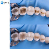 The Biomimetic Concept: Composite Restoration Protocols