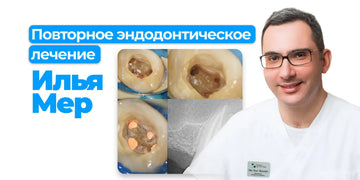 Повторное эндодонтическое лечение: авторские протоколы Ильи Мера