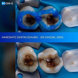 The Biomimetic Concept: Composite Restoration Protocols