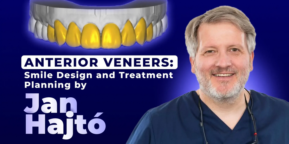 Anterior Veneers: Smile Design and Treatment Planning (Jan Hajtó)