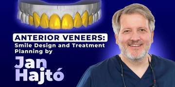 Anterior Veneers: Smile Design and Treatment Planning (Jan Hajtó)
