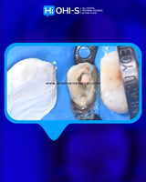 The Biomimetic Concept: Composite Restoration Protocols