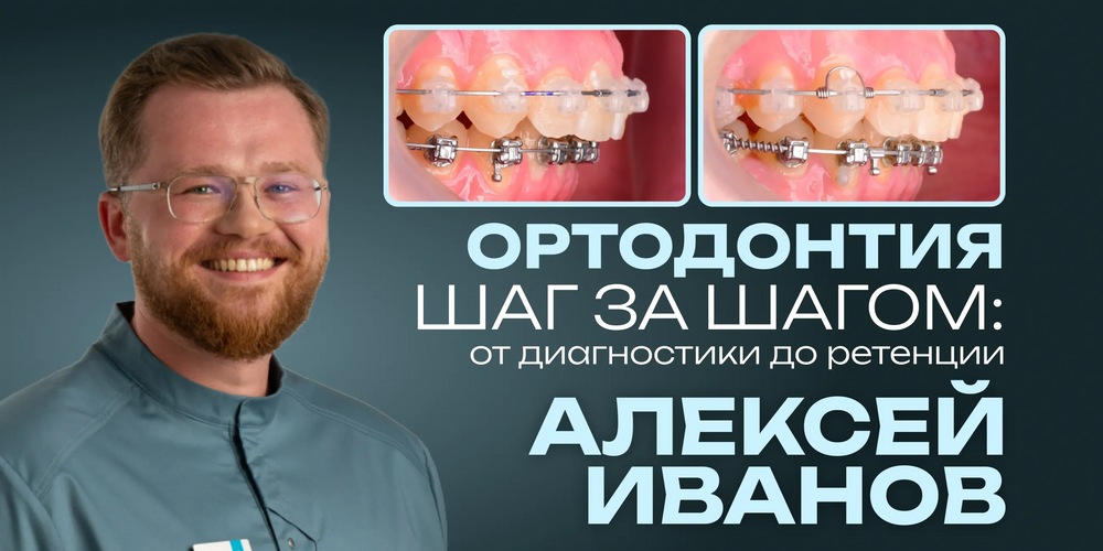 Orthodontics Step by Step: From Diagnosis to Retention