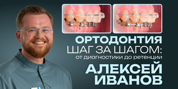 Orthodontics Step by Step: From Diagnosis to Retention