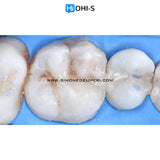 The Biomimetic Concept: Composite Restoration Protocols