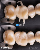 The Biomimetic Concept: Composite Restoration Protocols