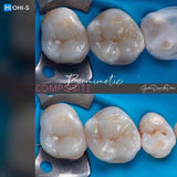 The Biomimetic Concept: Composite Restoration Protocols