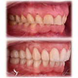 TMJ radiology and occlusion: vertical dimension, intra-articular disorders, centric relation