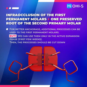 Early Orthodontic Treatment: When and How?