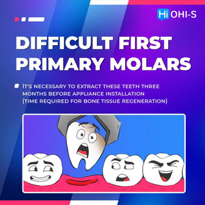 Early Orthodontic Treatment: When and How?