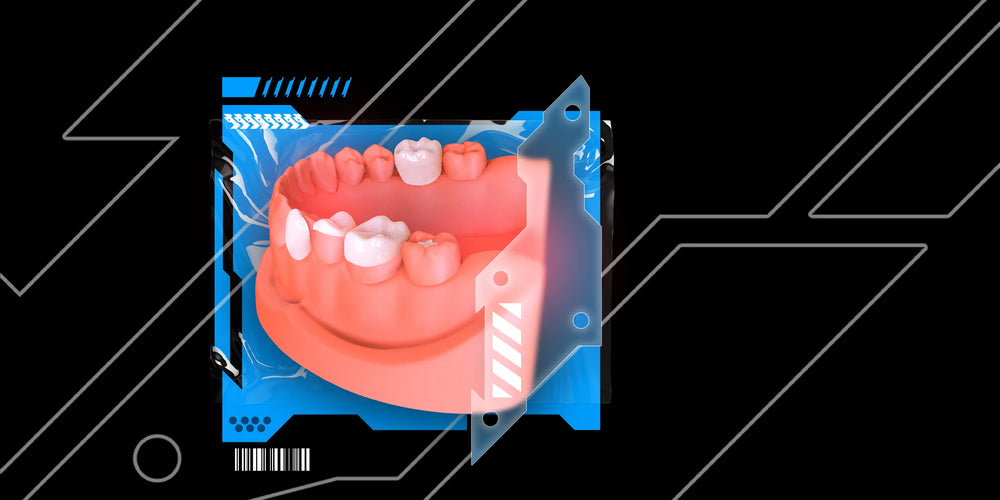 Veneers, Inlays, Onlays and Crowns: Full Protocols