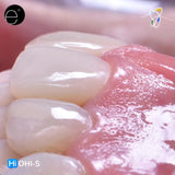 Composite Veneers, All Restorative Techniques